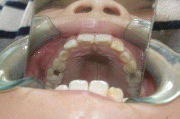 7岁男童嘴里长出“怪虫” 每天刷牙钻出两三条 征地拆迁 第2张
